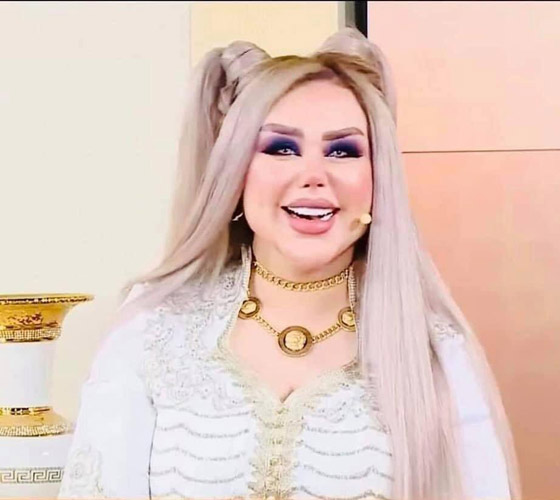 فيديو وصور داليا نعيم بعد التجميل! وملك جمال لبنان يرد: هذا غش واعتداء على ربنا!  صورة رقم 5