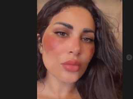 هجوم على ندى الكامل طليقة أحمد الفيشاوي لتحريف آية قرآنية وتزعم حرق وجهها! صورة رقم 3