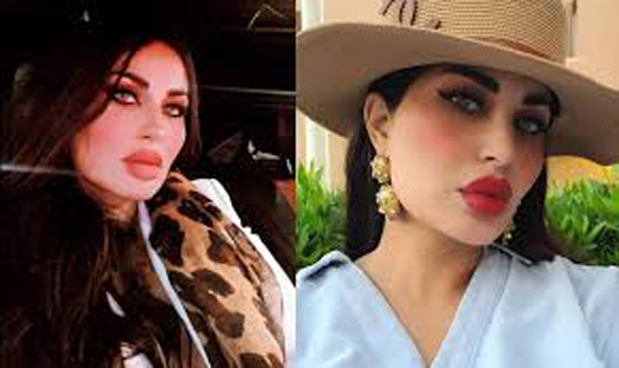 هجوم على ندى الكامل طليقة أحمد الفيشاوي لتحريف آية قرآنية وتزعم حرق وجهها! صورة رقم 7