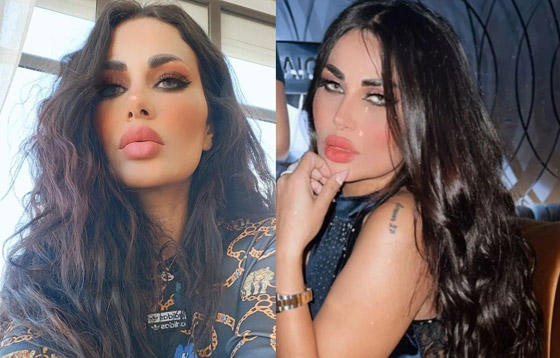 هجوم على ندى الكامل طليقة أحمد الفيشاوي لتحريف آية قرآنية وتزعم حرق وجهها! صورة رقم 8