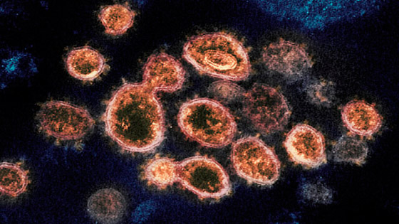 فيروس لانغا: فيروس حيواني جديد يُصيب عشرات الأشخاص في الصين صورة رقم 2