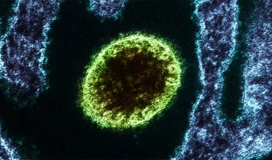 فيروس لانغا: فيروس حيواني جديد يُصيب عشرات الأشخاص في الصين صورة رقم 5