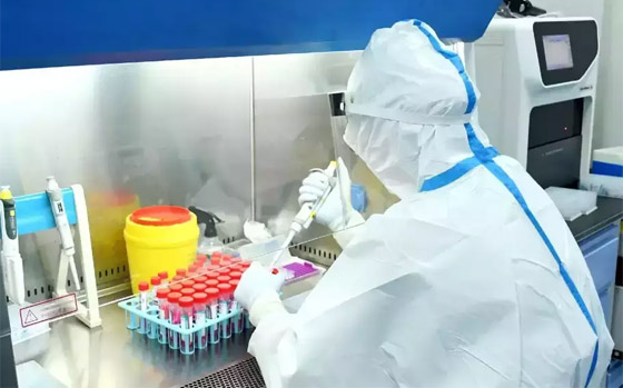 فيروس لانغا: فيروس حيواني جديد يُصيب عشرات الأشخاص في الصين صورة رقم 6