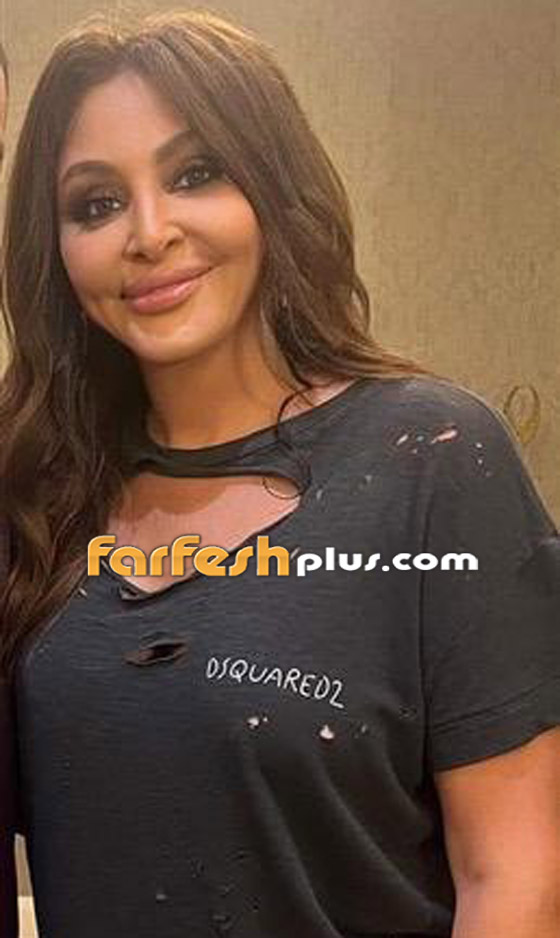 صور إليسا تصدم الجمهور بسبب عملية تجميل فاشلة لنفخ شفاهها صورة رقم 2