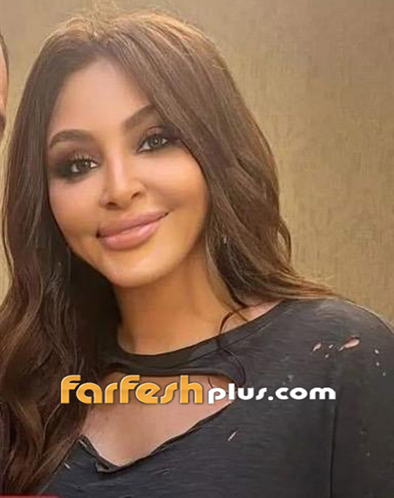 صور إليسا تصدم الجمهور بسبب عملية تجميل فاشلة لنفخ شفاهها صورة رقم 3
