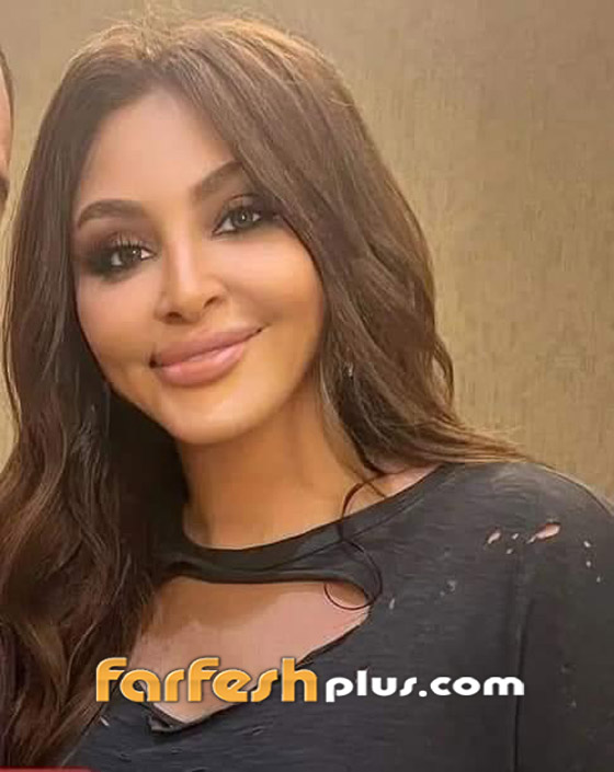 صور إليسا تصدم الجمهور بسبب عملية تجميل فاشلة لنفخ شفاهها صورة رقم 1