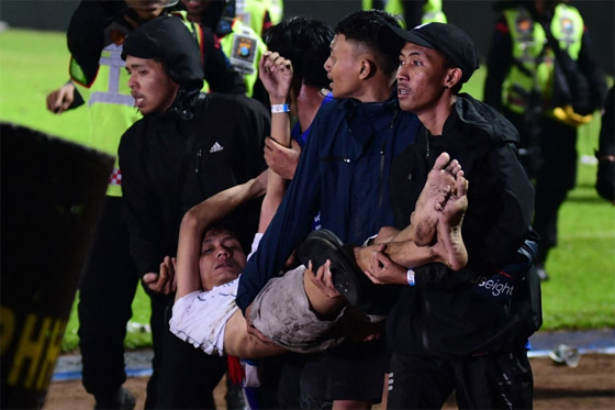 فيديو: 174 قتيلا و180 جريحا بأعمال شغب عقب مباراة كرة قدم بإندونيسيا صورة رقم 17