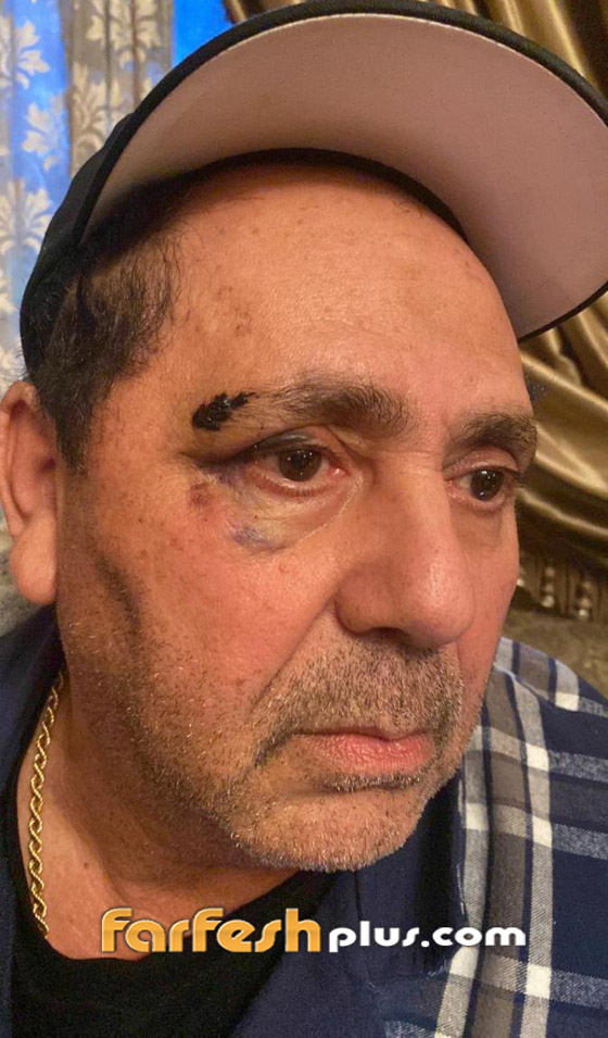 زوج علا غانم يفضحها: تتعاطى المخدرات هي وابنتها وضربتني بزجاجة نبيذ! فيديو صورة رقم 2