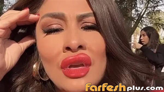 فيديو وصور: ياسمين عبد العزيز بوجه غريب وشفاه منتفخة! عملية تجميل أم فلتر؟ صورة رقم 2