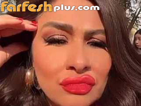 فيديو وصور: ياسمين عبد العزيز بوجه غريب وشفاه منتفخة! عملية تجميل أم فلتر؟ صورة رقم 4