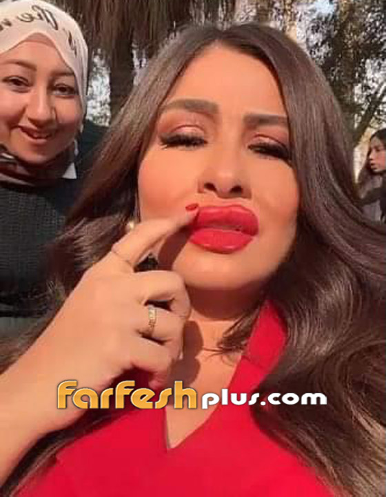 فيديو وصور: ياسمين عبد العزيز بوجه غريب وشفاه منتفخة! عملية تجميل أم فلتر؟ صورة رقم 5