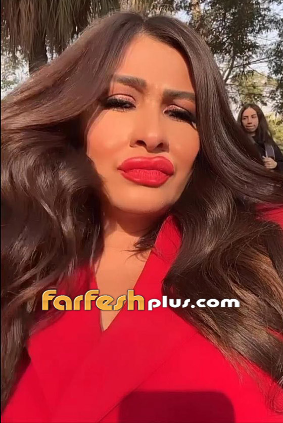 فيديو وصور: ياسمين عبد العزيز بوجه غريب وشفاه منتفخة! عملية تجميل أم فلتر؟ صورة رقم 6