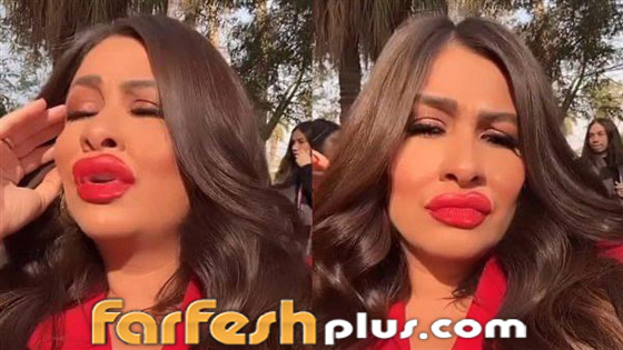 فيديو وصور: ياسمين عبد العزيز بوجه غريب وشفاه منتفخة! عملية تجميل أم فلتر؟ صورة رقم 7