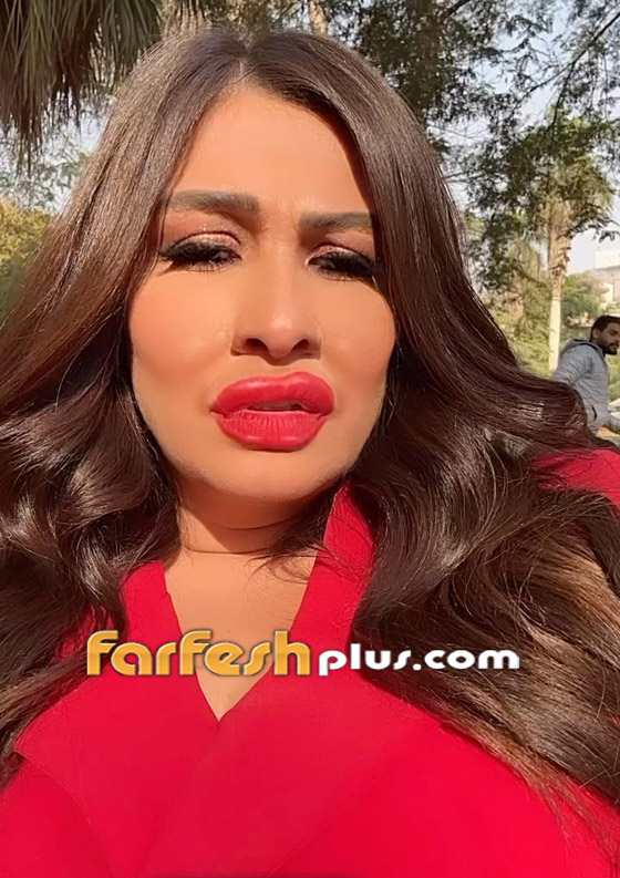 فيديو وصور: ياسمين عبد العزيز بوجه غريب وشفاه منتفخة! عملية تجميل أم فلتر؟ صورة رقم 1