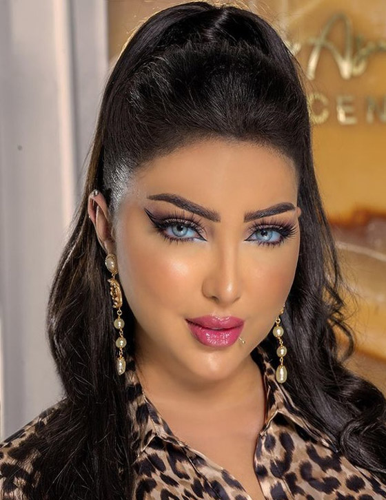 صور: نجمات بعد عمليات التجميل أصبحن كأنهن نسخة واحدة!  صورة رقم 2
