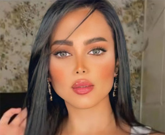 صور: نجمات بعد عمليات التجميل أصبحن كأنهن نسخة واحدة!  صورة رقم 12