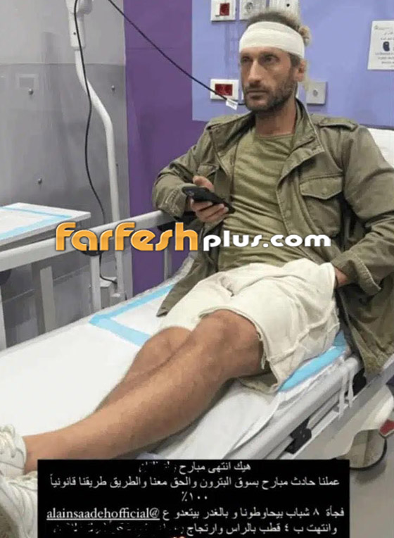 فيديو: اعتداء بالضرب البارح على ممثل لبناني بحضور زوجته.. أصيب بارتجاج في المخ!! صورة رقم 2