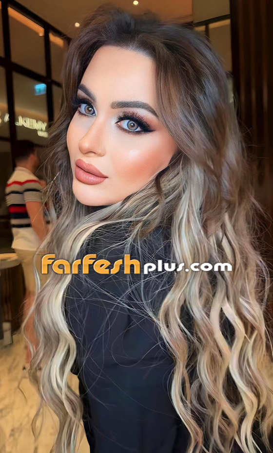 انتقادات شديدة للسورية فرح يوسف بعد عمليات التجميل! تغيير صادم في شكلها! فيديو وصور صورة رقم 5