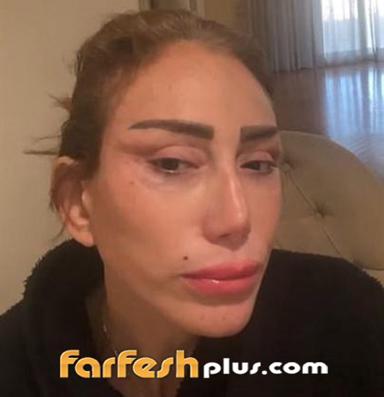 ريهام سعيد تفتح قضية طبيب التجميل اللبناني نادر صعب.. أنت دمرتني وشوهتني! صورة رقم 12