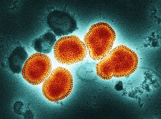 علماء كبار يحذرون: الإنفلونزا قد تكون وراء الجائحة المقبلة صورة رقم 4
