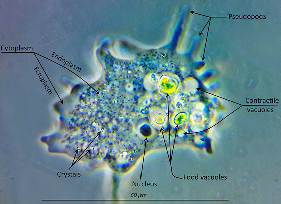 العلماء يدقون ناقوس الخطر من الأميبا.. عدوى 