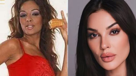 صورة قديمة لـ نادين نجيم تصدم جمهورها! شكلها مختلف تماما واتهامات بعمليات تجميل ونادين ترد: ما كنت بعرف حط ميك آب! صورة رقم 2