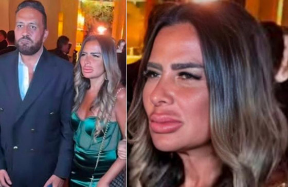 زوجة فنان مصري تشعل ضجة بسبب تشوه شفتيها بعد عملية حقن (فيلر) فاشلة! تبدو كأنها بـ شنب! صورة رقم 2 زوجة فنان مصري تشعل ضجة بسبب تشوه شفتيها بعد عملية حقن (فيلر) فاشلة! تبدو كأنها بـ شنب! صورة رقم 2