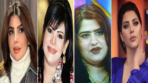 صور نجمات الكويت قبل وبعد عمليات التجميل: لن تصدق التغيير!